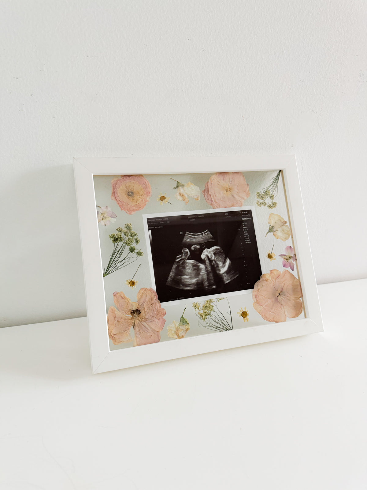 Custom Flower Sonogram Frame